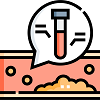 Lipid-Profile-Test